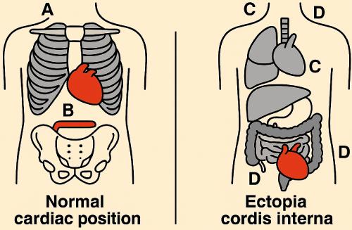 Ectopia Cordis Interna in an Asymptomatic Adult Male: A Rare Case Report