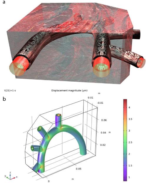 Design of Artificial Heart with EMP Protection
