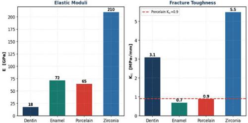 Dental Crown Fracture Failure Risk Based on Strain Energy Density