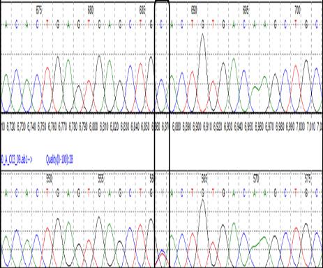 Hb M- Hyde Park - Rare Hemoglobinopathy in Tamil Nadu