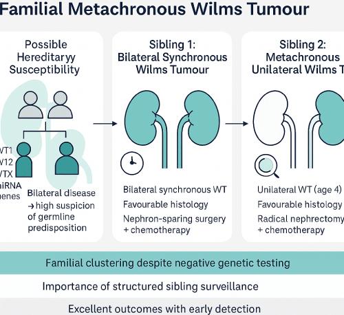 Familial Metachronous Wilms’ Tumour in a Sibling with Previous Bilateral Synchronous Wilms’ Tumour: A Rare Familial Cluster