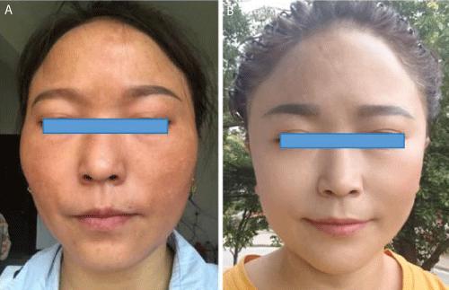 Cultivating a Dignified and Radiant Appearance Through Buddhism